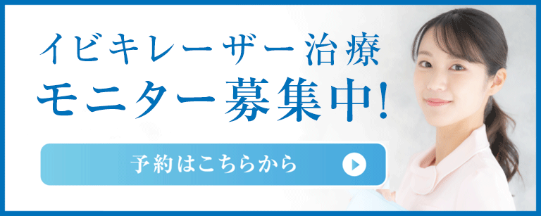 レーザー治療　モニター募集中